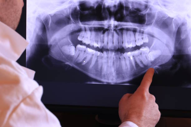 Best Emergency Dentist for Lost Fillings or Crowns in Enfield, NC